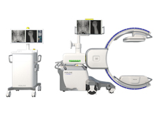 什么是移動式三維C形臂？它的臨床優(yōu)勢體現(xiàn)在哪？