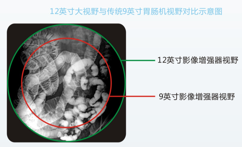 數(shù)字化平板胃腸機PLD8600B