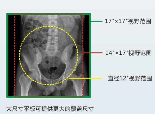 動態(tài)DR成像視野