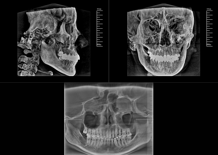 數(shù)字化口腔CBCT影像