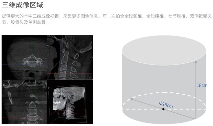 移動三維C形臂術(shù)中成像